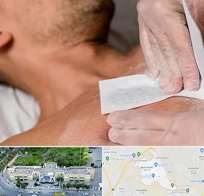 اپیلاسیون آقایان در نسیم شهر