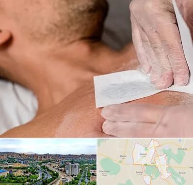 اپیلاسیون آقایان در شهریار