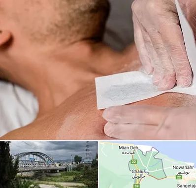 اپیلاسیون آقایان در چالوس