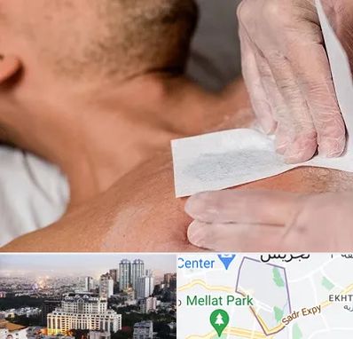 اپیلاسیون آقایان در الهیه 