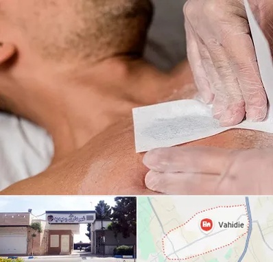 اپیلاسیون آقایان در وحیدیه شهریار