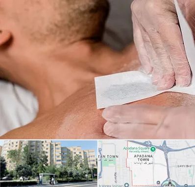 اپیلاسیون آقایان در آپادانا