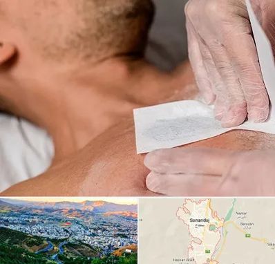 اپیلاسیون آقایان در سنندج