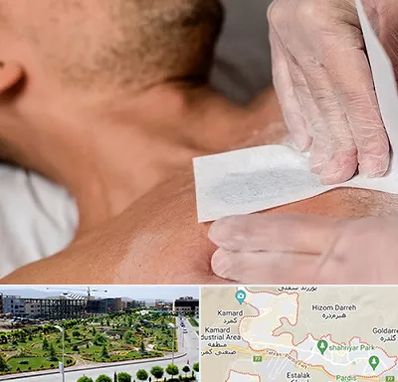 اپیلاسیون آقایان در پردیس