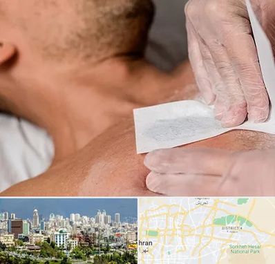 اپیلاسیون آقایان در شرق تهران 