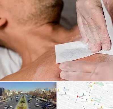 اپیلاسیون آقایان در بلوار معلم مشهد