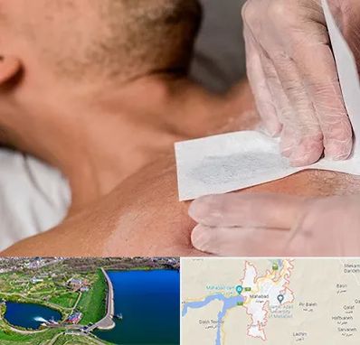 اپیلاسیون آقایان در مهاباد