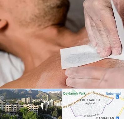 اپیلاسیون آقایان در اختیاریه 