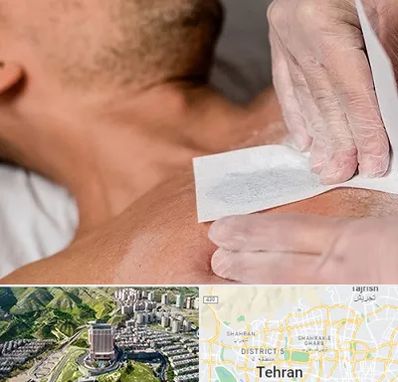 اپیلاسیون آقایان در شمال تهران 