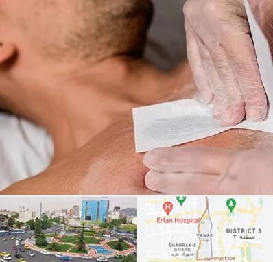 اپیلاسیون آقایان در ونک 