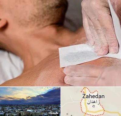 اپیلاسیون آقایان در زاهدان