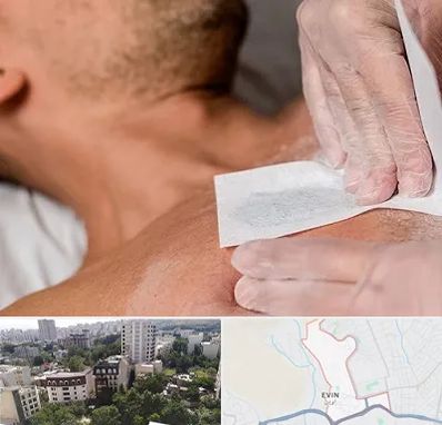 اپیلاسیون آقایان در اوین