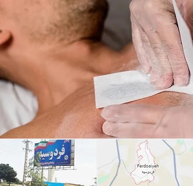 اپیلاسیون آقایان در فردوسیه شهریار