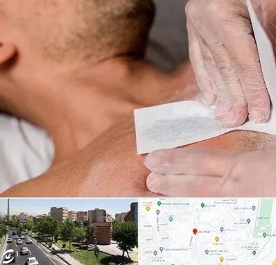 اپیلاسیون آقایان در شهرک آزمایش 