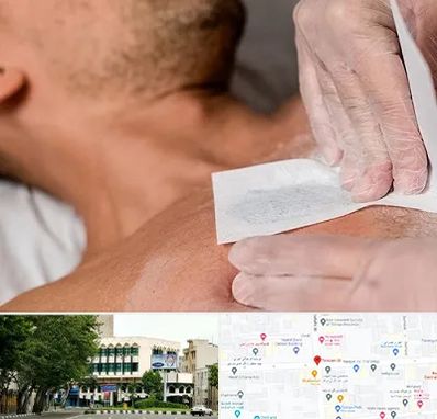 اپیلاسیون آقایان در طالقانی 