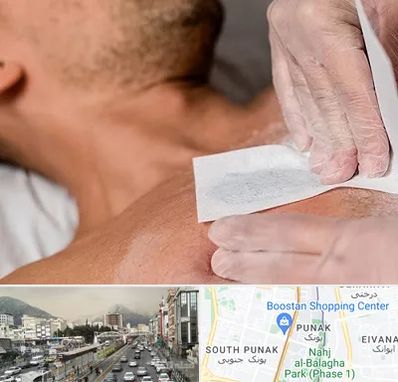 اپیلاسیون آقایان در پونک 