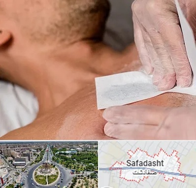 اپیلاسیون آقایان در صفادشت