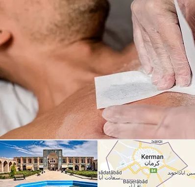 اپیلاسیون آقایان در کرمان