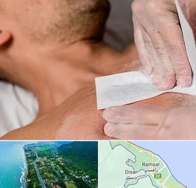 اپیلاسیون آقایان در رامسر