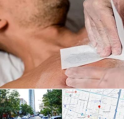 اپیلاسیون آقایان در امامت مشهد