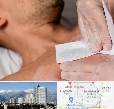 اپیلاسیون آقایان در شهرک غرب 