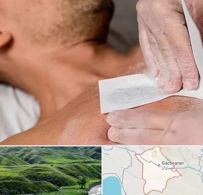 اپیلاسیون آقایان در گچساران