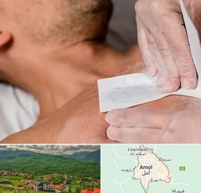 اپیلاسیون آقایان در آمل