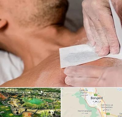 اپیلاسیون آقایان در بروجرد