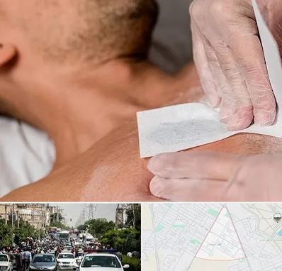 اپیلاسیون آقایان در سیدی مشهد