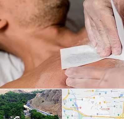 اپیلاسیون آقایان در کن 