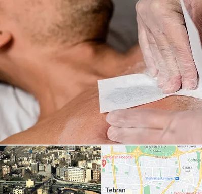 اپیلاسیون آقایان در مرزداران 