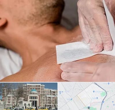 اپیلاسیون آقایان در طلاب مشهد