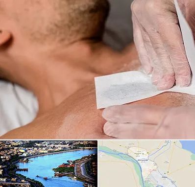 اپیلاسیون آقایان در خرمشهر