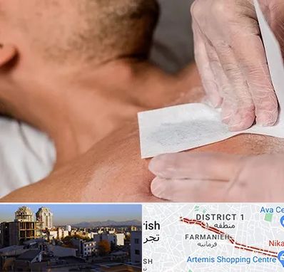 اپیلاسیون آقایان در فرمانیه 