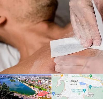 اپیلاسیون آقایان در لاهیجان