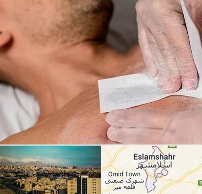 اپیلاسیون آقایان در اسلامشهر