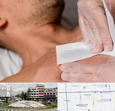 اپیلاسیون آقایان در مرکز تهران