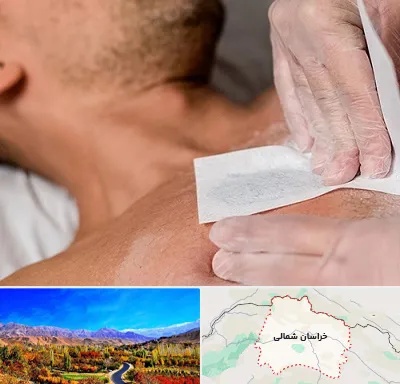 اپیلاسیون آقایان در خراسان شمالی