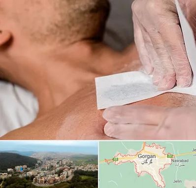 اپیلاسیون آقایان در گرگان