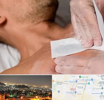 اپیلاسیون آقایان در مارلیک کرج