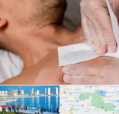 اپیلاسیون آقایان در چیتگر 