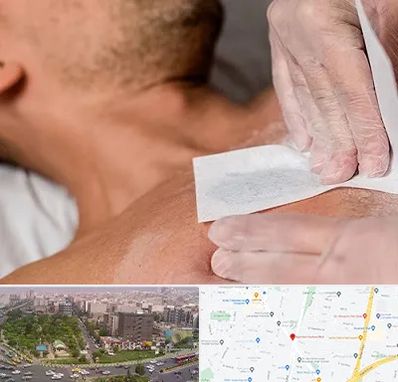 اپیلاسیون آقایان در آیت الله کاشانی 