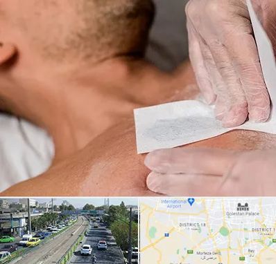 اپیلاسیون آقایان در جنوب تهران 