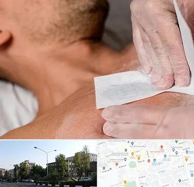 اپیلاسیون آقایان در میدان کاج 