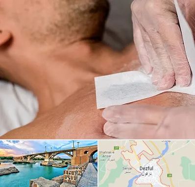 اپیلاسیون آقایان در دزفول