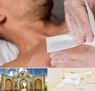 اپیلاسیون آقایان در سمنان