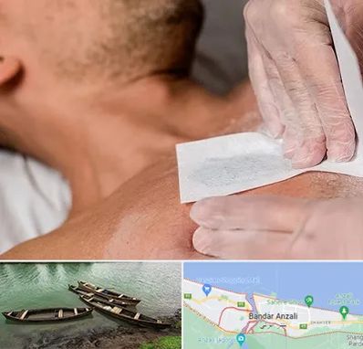 اپیلاسیون آقایان در بندر انزلی