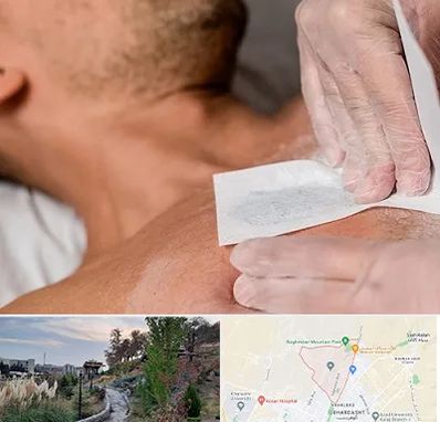 اپیلاسیون آقایان در باغستان کرج