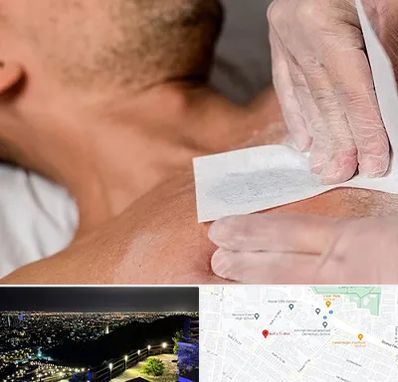 اپیلاسیون آقایان در هفت تیر مشهد