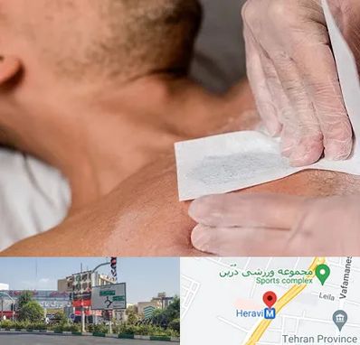 اپیلاسیون آقایان در هروی 